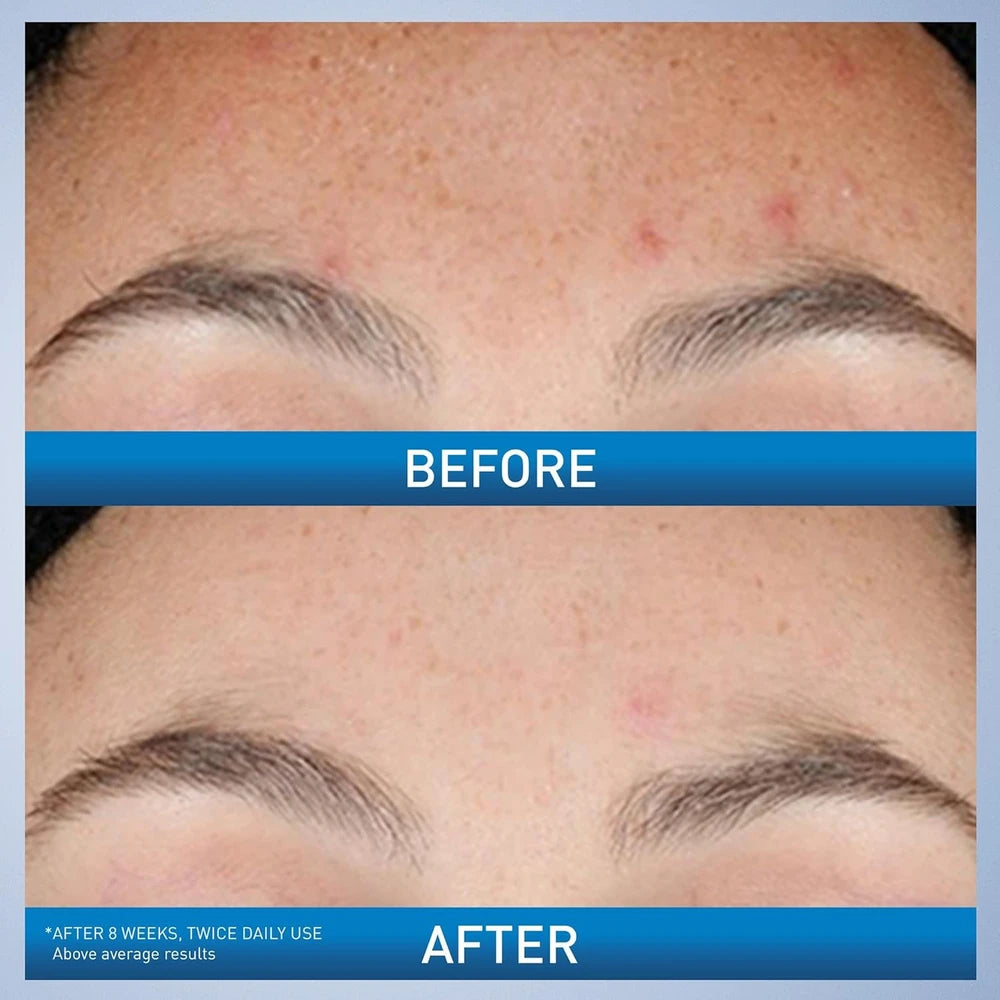 CeraVe Resurfacing Retinol Serum