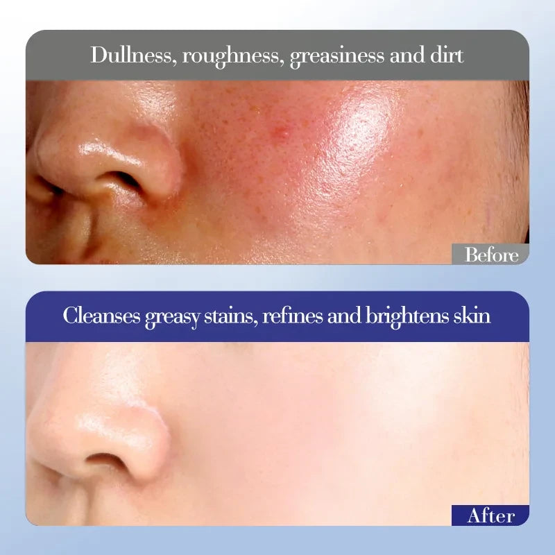 Evening Primrose Vitamin E Skincare Set