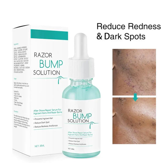Anti-Ingrown Hair Post-Shave Serum